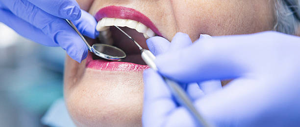 Best Broken or Chipped Tooth Repair in Mount Carmel, TN